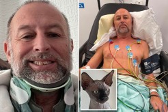 A UK man was left with a broken neck, fractured spine and other "car crash"-evoking injuries after tripping over his cat.